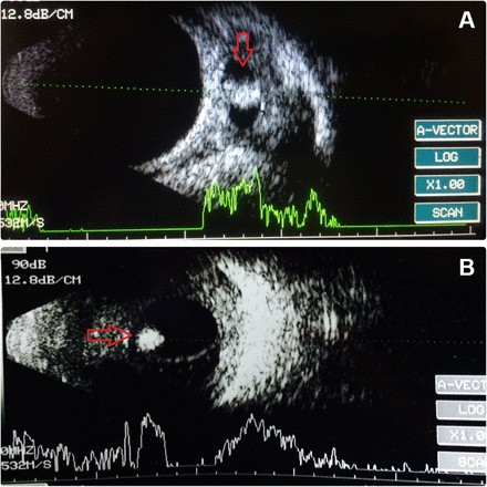 Detailed view from a B scan tool display highlighting key diagnostic data points within a vehicle's system.