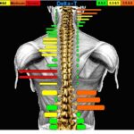 Chiropractic Princeton NJ Tytron Scan